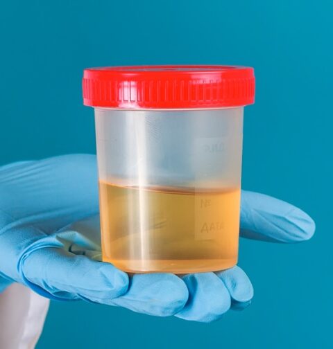 Qué dice el color de la orina sobre la salud y cuándo conviene consultar
