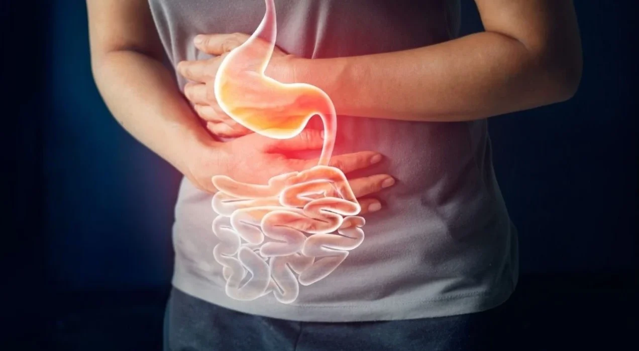 Cuáles son las comidas que causan la acidez estomacal y claves prevenirla