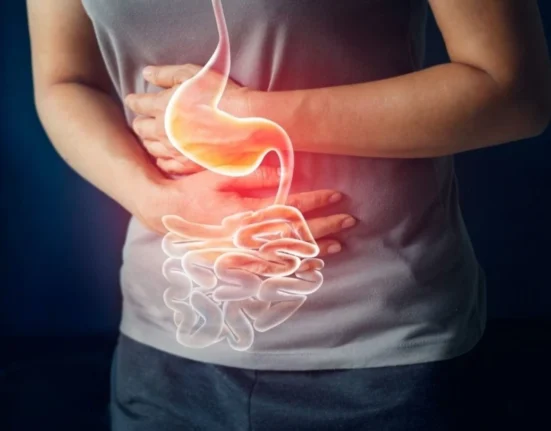 Cuáles son las comidas que causan la acidez estomacal y claves prevenirla